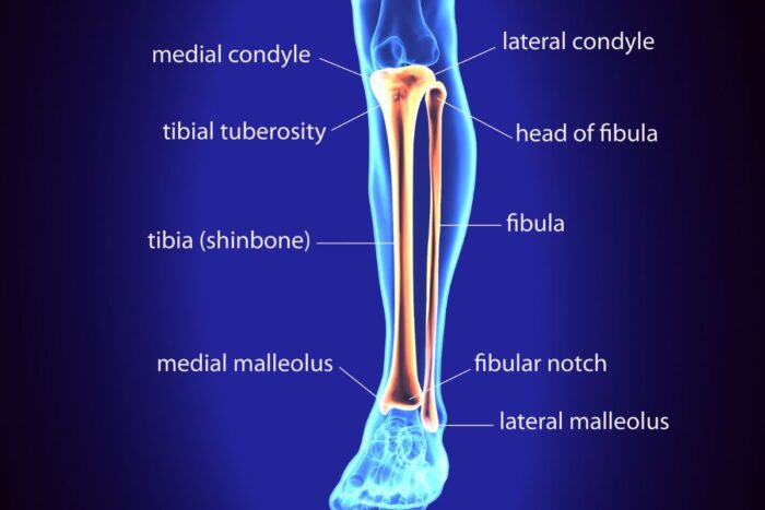 Frattura Tibia E Perone La Riabilitazione E I Tempi Di Recupero Fisioterapia E Riabilitazione